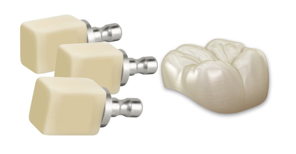 CAD/CAM Crowns (1-Visit)