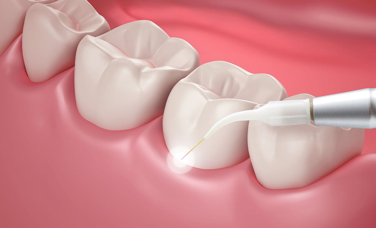 Routine Cleanings & Periodontal Therapy